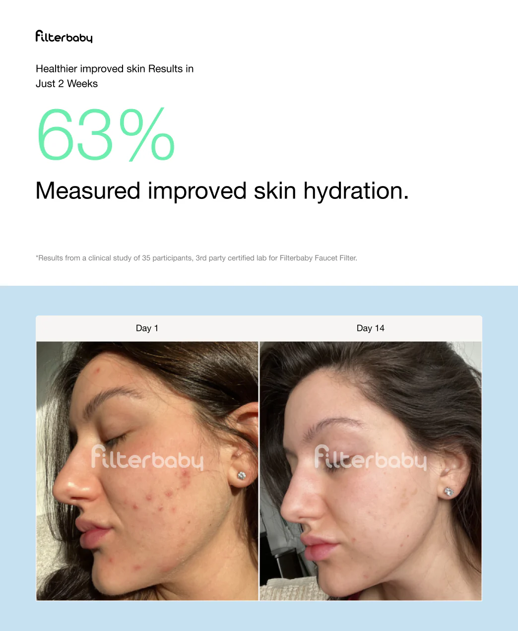 Get Filterbaby Diamond Series Shower Filter - Image 26