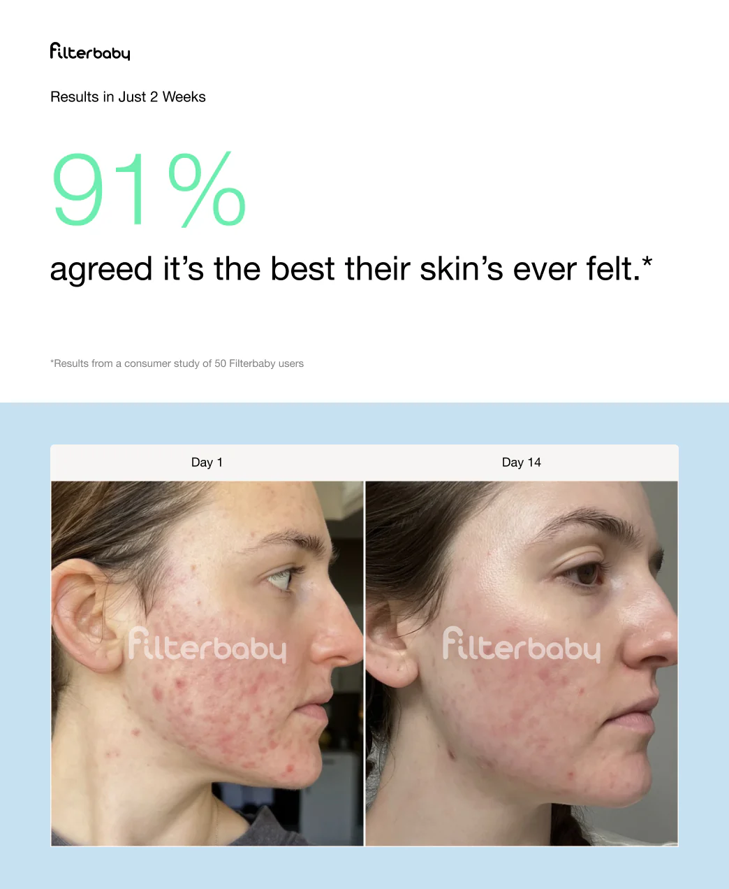 Get Filterbaby Skincare Filter 2.0 - Try Now - Image 28