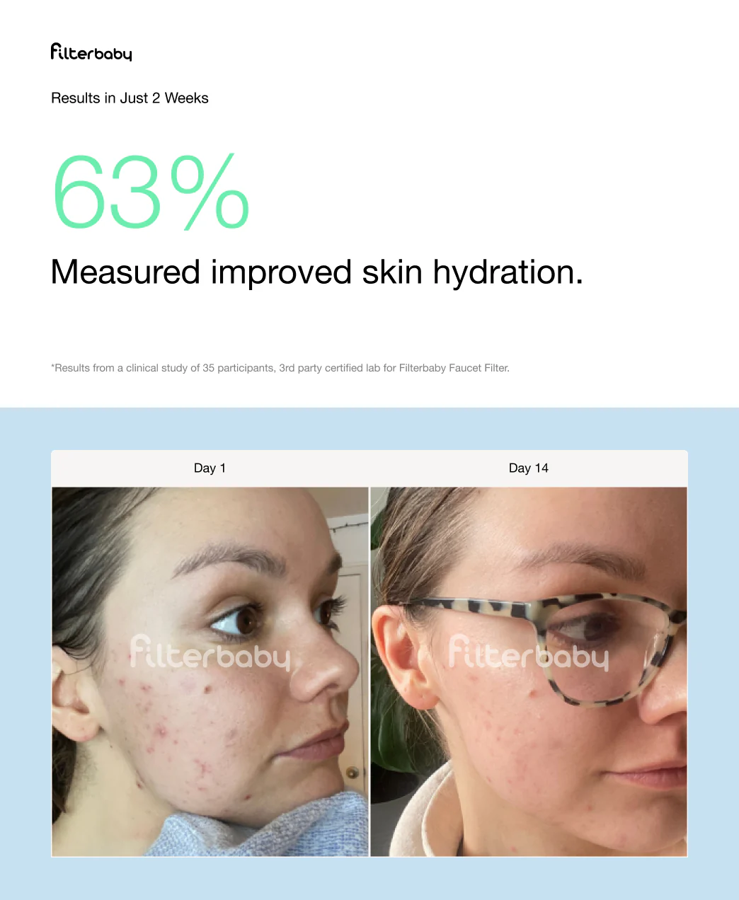 Filterbaby Pro Series Titanium Aluminum Shower Filter - Try Now - Image 29