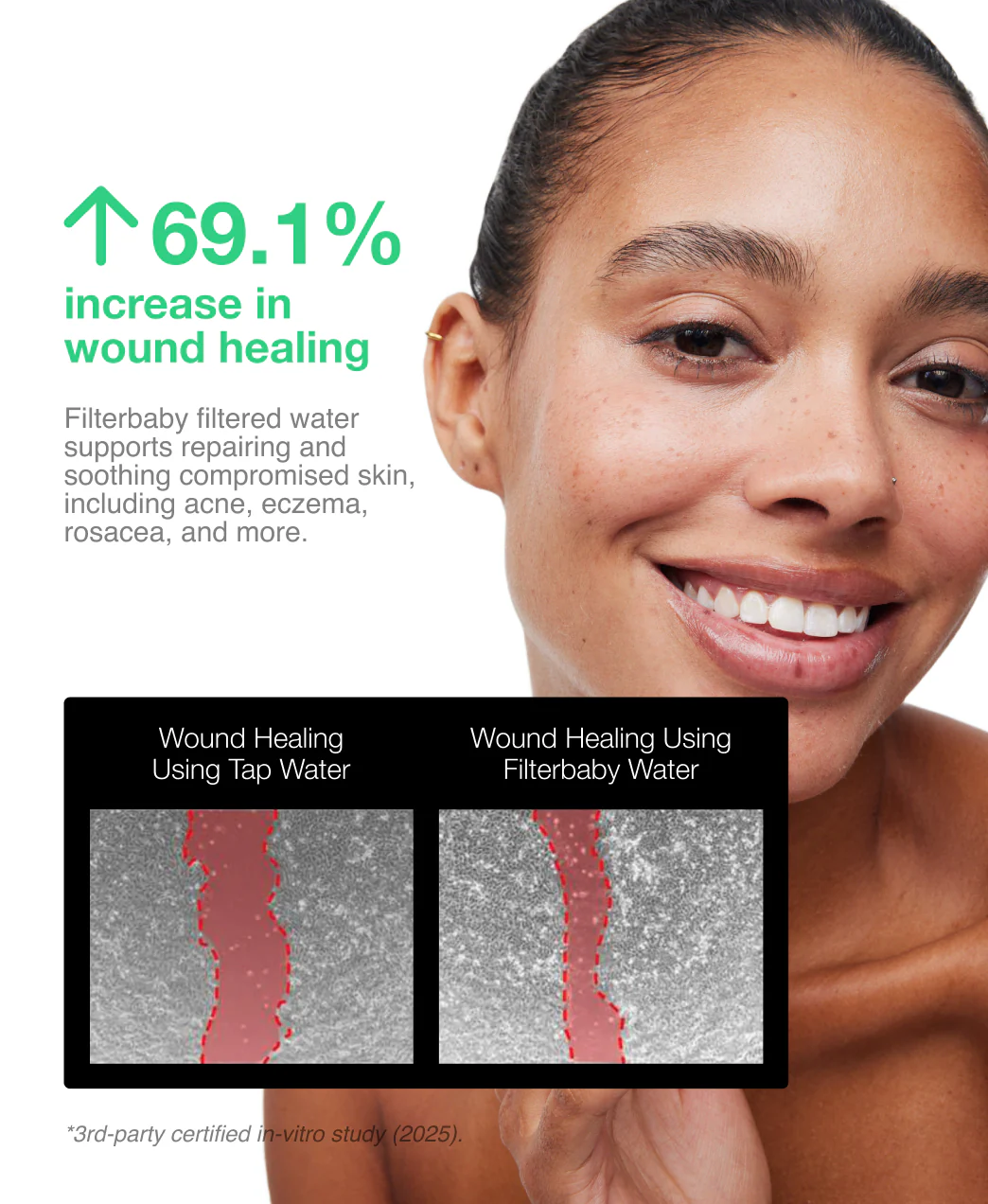 Get Filterbaby Skincare Filter 2.0 (2-Pack) - Image 51