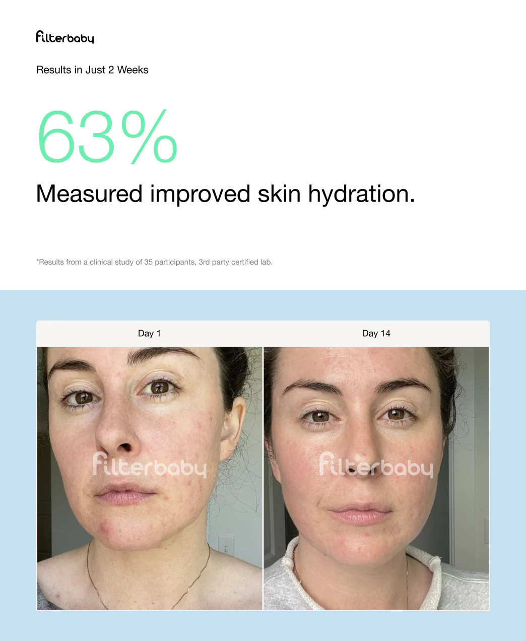 Filterbaby Skincare Faucet Filter 2.0 (3-Cycle Minimum) - Image 15